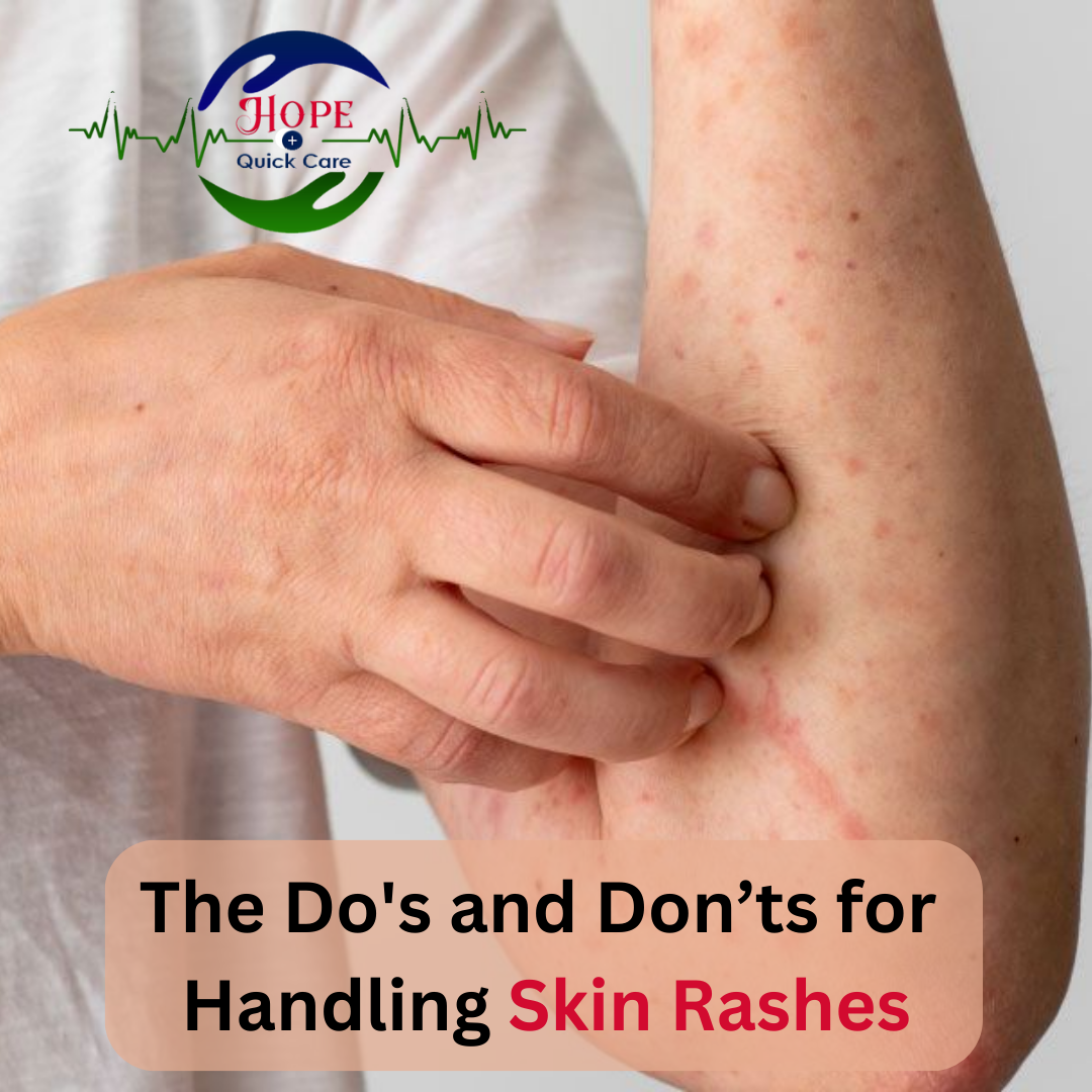 Skin Rashes