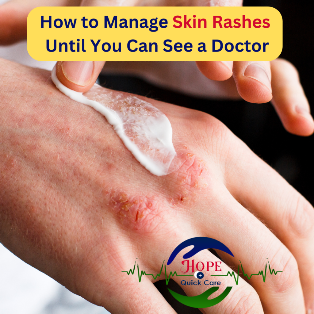 How to Manage Skin Rashes Until You Can See a Doctor