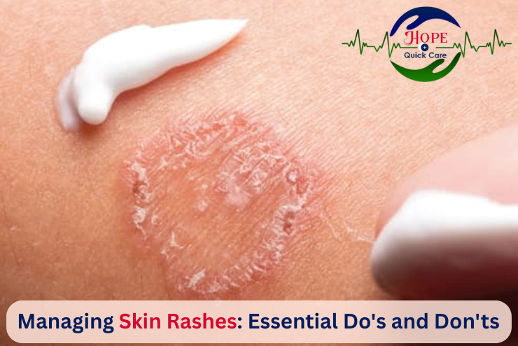 Skin Rashes