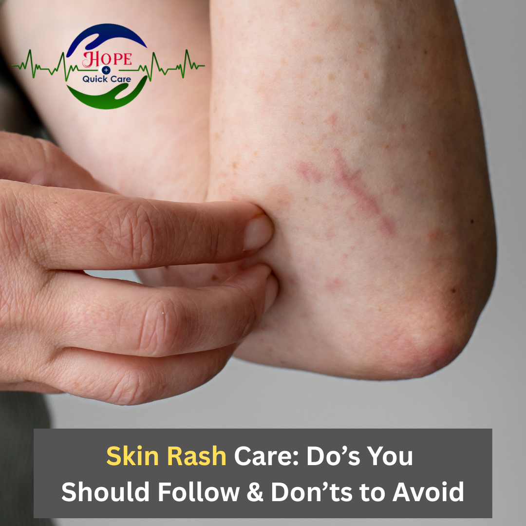 Skin Rash Care